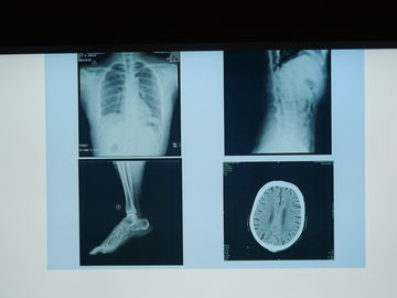 Prenda impermeable de la película de la proyección de imagen médica de Konida X Ray para la impresora de Agfa