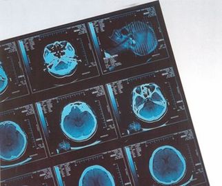 Termal seca médica de la película de X Ray de Digitaces para el CR/dr del hospital