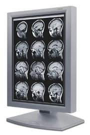 Exhibiciones del grado médico de la imagen clara, exhibición médica de la escala gris 5MP