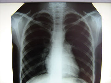 Película de radiografía médica clara del hospital Konida con las impresoras térmicas