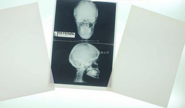 Konida el 10in el x 12in X Ray Medical Imaging