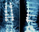 Películas médicas de X Ray de la alta agudeza