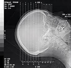 Proyección de imagen de diagnóstico de plata del laser X Ray del haluro, película impermeable de la transparencia A3/A4