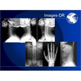 Máquina de la radiografía de Digitaces de la RADIOGRAFÍA de Mammogrpahy con el brazo flexible del UC