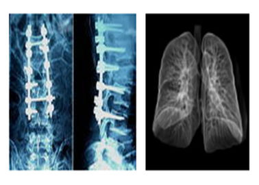 Películas médicas radiográficas agudas de X Ray, película del Dr. Ct Digital Dry Imaging de Mri