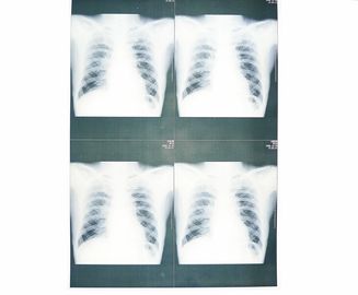 Película médica baja blanca del papel de X Ray a prueba de humedad para Sony/la impresora laser de EPSON