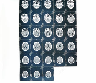 Proyección de imagen de diagnóstico médica de la impresora laser X Ray del papel para el hospital