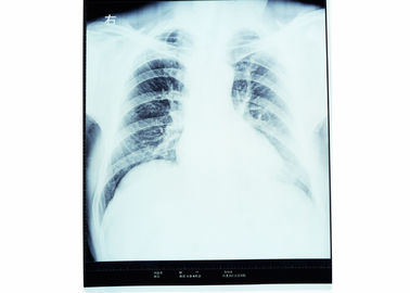 termal sensible de la película seca médica de la proyección de imagen de 10 x 14 radiografías para la impresora de Fuji