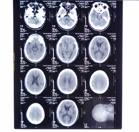 el 11in * la proyección de imagen médica seca de la radiografía del 14in filma KND-A para AGFA 5300, 5302, 5500, 5502, 3000