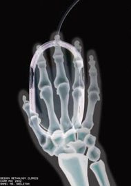 Película seca de la proyección de imagen médica de la transparencia, película termal de X Ray de Agfa Digital