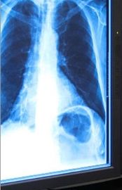 Película seca médica azul de la proyección de imagen, película del laser Fuji X Ray del 11in del x 14in