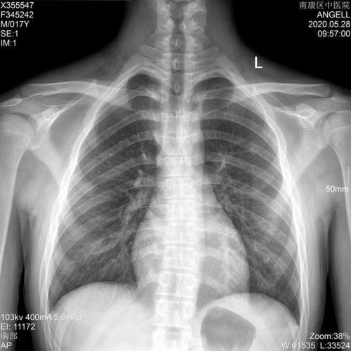 Latest company blogs about Película médica de rayos X