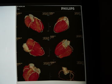 Good price película seca médica de la proyección de imagen de los 35cm de los x 43cm, película de la radiografía del pecho de la transparencia en línea