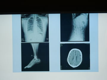 Good price Prenda impermeable de la película de la proyección de imagen médica de Konida X Ray para la impresora de Agfa en línea