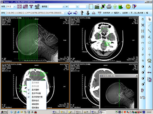 Buen precio 8 proyección de imagen de diagnóstico médica del laser X Ray del papel de x 10inch para KND-DRYTEC 4000 en línea