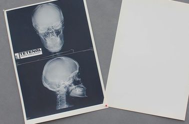 Good price Alta agudeza del pecho X Ray de la prenda impermeable de papel médica blanca de la película en línea