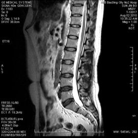 Good price Película seca médica rígida a prueba de humedad los 8in el x 10in de X Ray para la impresora térmica en línea