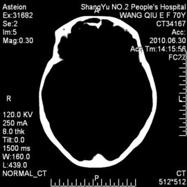 Good price termal sensible de la película seca médica de la proyección de imagen de 10 x 14 radiografías para la impresora de Fuji en línea