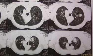 Good price Película seca médica respetuosa del medio ambiente Agfa 2B X Ray con la máquina del CT en línea