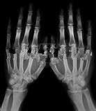 Buen precio película médica del papel de la radiografía de la niebla baja del 13in * del 17in para la impresora laser de Konida en línea