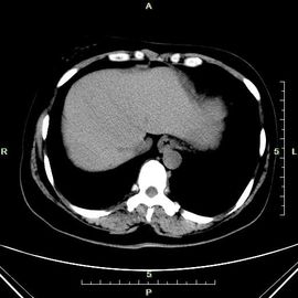 Buen precio Papel azul del laser de la proyección de imagen de diagnóstico fina de Konida X Ray para la máquina de radiografía en línea