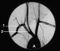 Good price Películas médicas de X Ray de Konida en línea