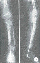 Good price X Ray médico seco impermeable filma Konida brillante para AGFA/Fuji en línea