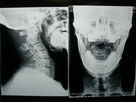 Good price Película de alta densidad X Ray de la proyección de imagen médica seco para Fuji 3000/2000/1000 en línea