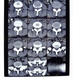 Buen precio el 10in * el 12in películas secas de alta densidad de la proyección de imagen médica del 11in * del 14in para la impresora de AGFA/de Fuji en línea