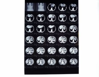 Película seca de X Ray de Drypix 2000 8 x 10 pulgadas Scrach resistente para Fuji 3000
