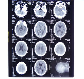 Good price el 11in * la proyección de imagen médica seca de la radiografía del 14in filma KND-A para AGFA 5300, 5302, 5500, 5502, 3000 en línea