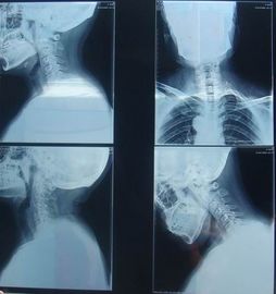 Buen precio Película seca de papel médica resistente al rayado de la proyección de imagen de KND-K para el examen radiográfico en línea