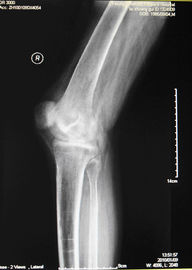 Buen precio Película seca médica de la proyección de imagen de la niebla baja de KND-A para el examen de X Ray en AGFA 5300, 5302, 5500 en línea