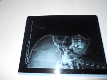 Buen precio Película seca médica favorable al medio ambiente de la proyección de imagen de KND-A para el examen de X Ray en AGFA 5300 en línea