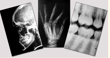 Good price Película seca médica azul de la proyección de imagen, película del laser Fuji X Ray del 11in del x 14in en línea