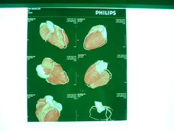 Good price Película seca médica de X Ray de Digitaces, Dt2b/película seca médica de la proyección de imagen de Dt1b Agfa en línea