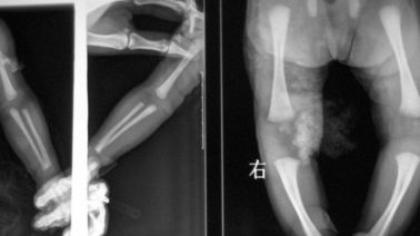 Good price proyección de imagen médica del laser X Ray de 20 de los x 25cm, película de DT1B/de DT2B Agfa X Ray en línea