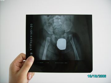 Good price Prenda impermeable Agfa fino DRYSTAR DT1B/DT2B de la proyección de imagen médica del laser X Ray del haluro de plata en línea