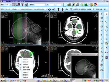 8 proyección de imagen de diagnóstico médica del laser X Ray del papel de x 10inch para KND-DRYTEC 4000