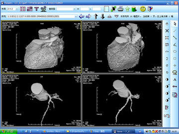Good price Haluro de plata de la proyección de imagen de diagnóstico de la impresora laser X Ray para KND-DRYTEC 4000 en línea