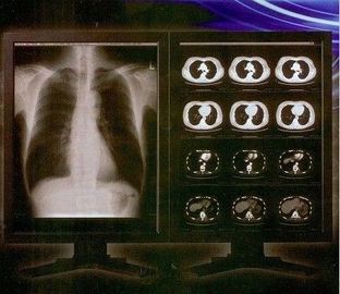 Película clara brillante de X Ray de Digitaces, película médica de la transparencia del laser de Konida
