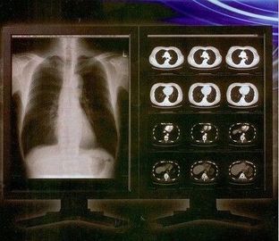 Good price Película clara brillante de X Ray de Digitaces, película médica de la transparencia del laser de Konida en línea