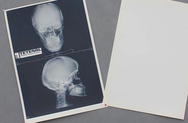Alta agudeza del pecho X Ray de la prenda impermeable de papel médica blanca de la película
