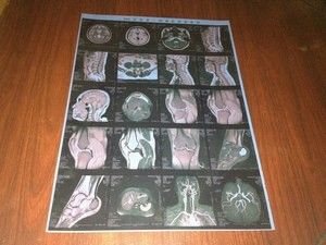 Good price Películas médicas de X Ray de la niebla baja, película seca de la alta de la agudeza radiografía de Konida en línea