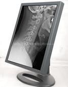 Good price la Anti-pantalla rasguña las exhibiciones del grado, tipo exhibiciones del 900:1 del coeficiente de contraste del grado médico en línea