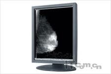 Exhibiciones del monitor LCD del grado médico