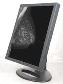 Good price Exhibiciones del monitor del grado médico en línea
