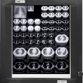 Películas médicas bajas blancas usables de X Ray, película del papel de la radiografía de la proyección de imagen médica