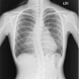 Películas médicas bajas blancas usables de X Ray, película del papel de la radiografía de la proyección de imagen médica