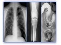 Good price Película olográfica de la proyección de imagen médica, película del ANIMAL DOMÉSTICO X Ray de las impresoras térmicas en línea